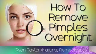 How To Remove Pimples (Overnight Natural Remedies)