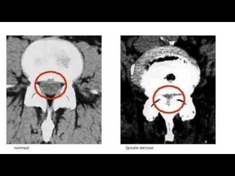 Ohr Mief in Osteochondrose Kaufen eine Bandage für das Kniegelenk in Voronezh