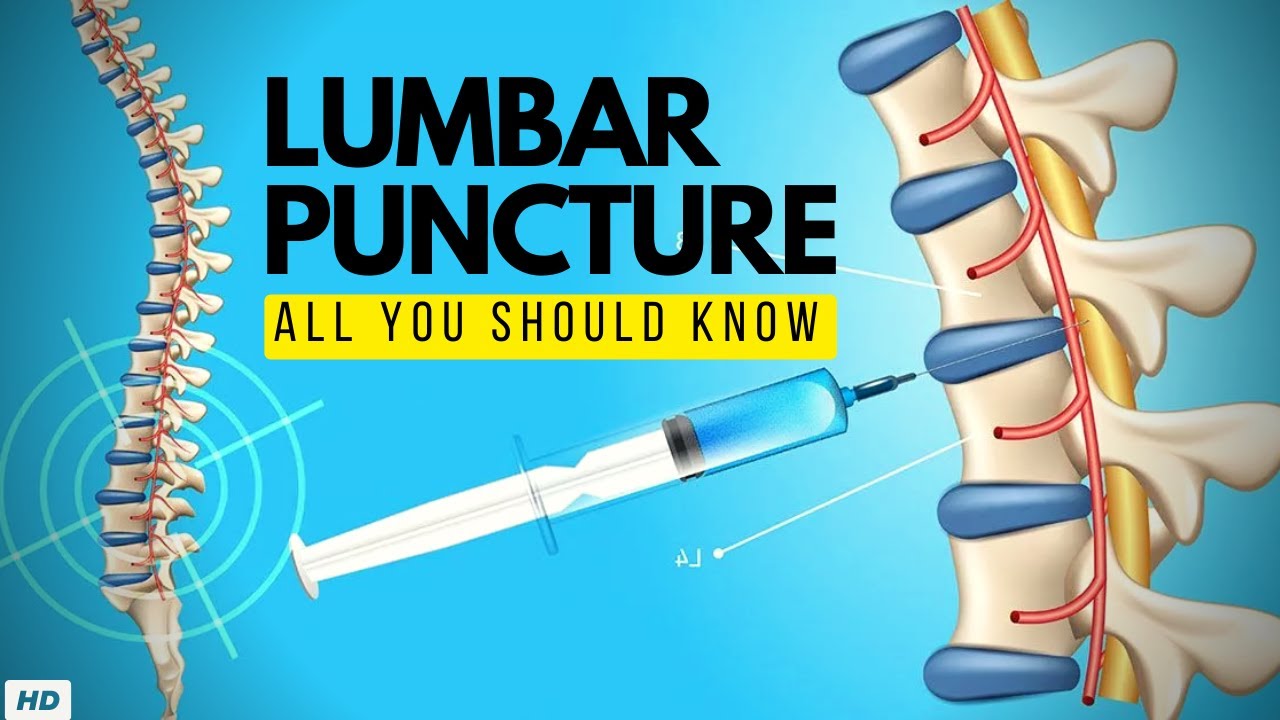 Lumbar Puncture:  Everything You Need to Know