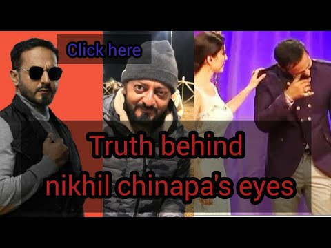 WHY DOES NIKHIL CHINAPA ALWAYS WEAR GLASSES?? Truth behind nikhil's glasses