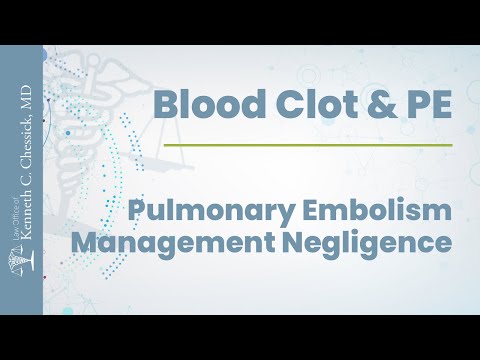 Blood Clot And Pulmonary Embolism Management Negligence