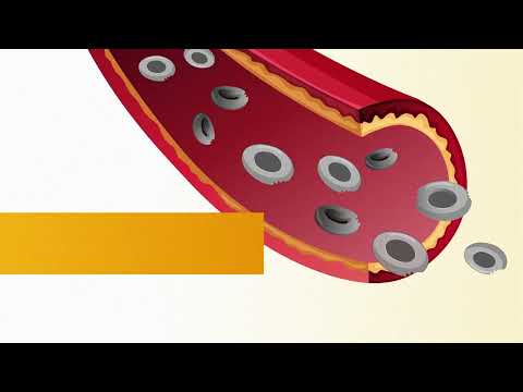 The haemolytic process in PNH