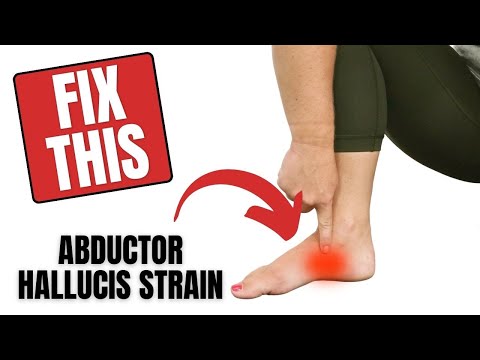 Abductor Hallucis Muscle Strain in Arch of Foot