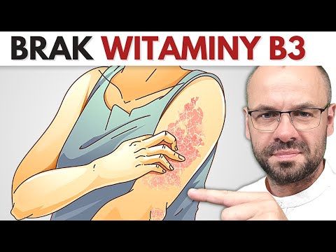 Signs of VITAMIN B3 deficiency.