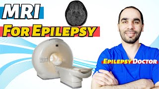 Download lagu Brain MRI for Epilepsy... mp3