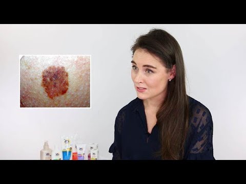 The facts about Melanoma with Dr Annika