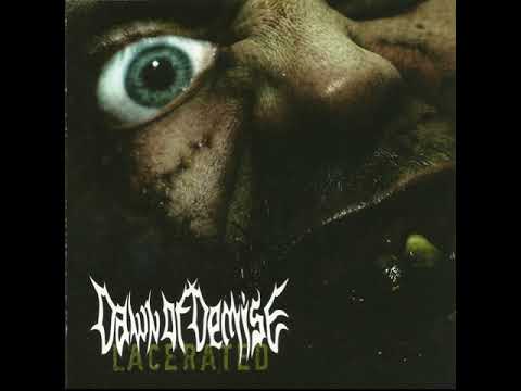 Dawn Of Demise 2008  -  Lacerated EP