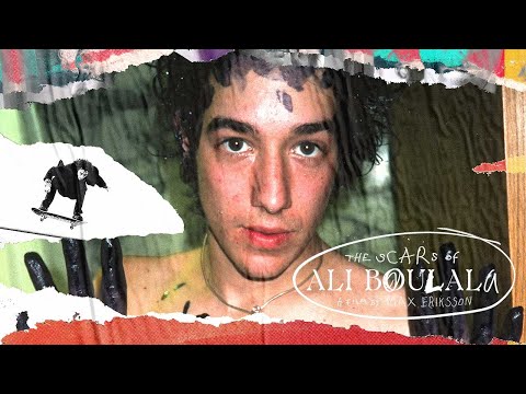 The Scars of Ali Boulala Trailer | Garage Entertainment