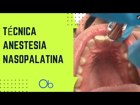 Técnica nasopalatina
