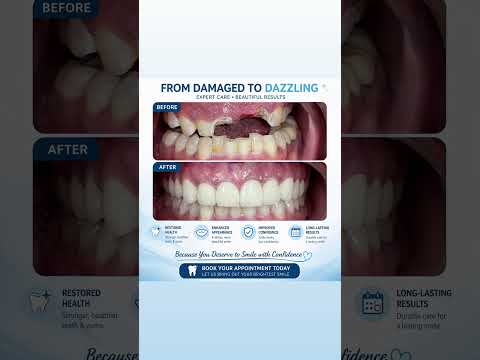 Transforming Smiles, Restoring Confidence | Dr. Dipali Dambal