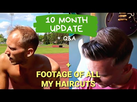 All My Haircuts After My Hair Transplant / 10 Month...