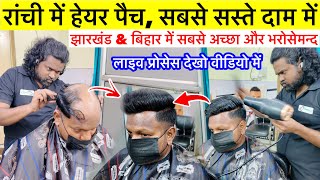 Hair Patch in Ranchi | Cheap and Best Hair Wig Ranchi Jharkhand, The Dreamers Looks Ranchi 2026 #wig