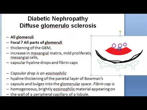 Diabetic neuropathy guidelines
