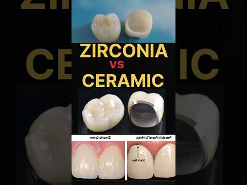 ZIRCONIA vs. PFM CROWN is equal to ELEGANCE vs TRADITIONAL CHARM! #dental #zirconia #trending #smile