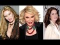 5 Selebritis Gagal Operasi Plastik