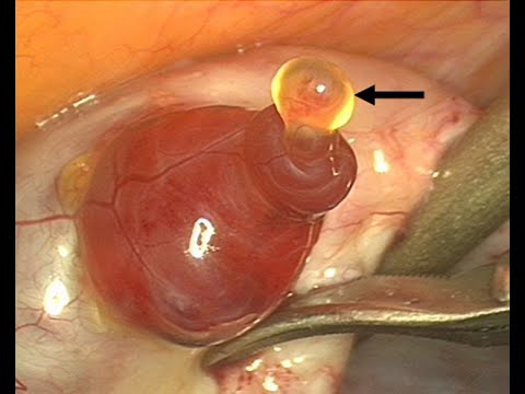 Female Gametogenesis (UNESP)