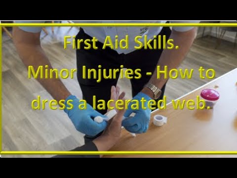 First Aid Skills. Minor Injuries. How to dress a wound between index finger and thumb.
