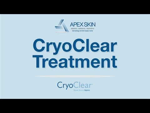 CryoClear Procedure Q&A - Lauren Karpinski, M.D - Apex Dermatology & Skin Surgery