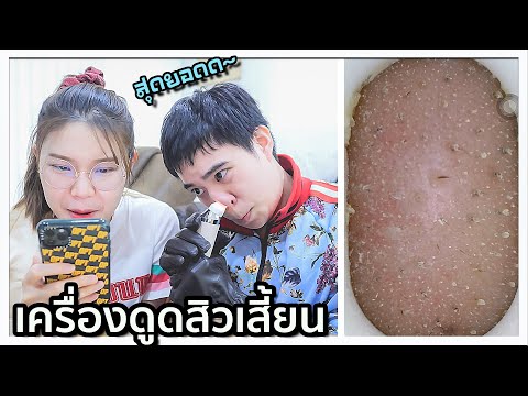 ฟีฟายแอดวาด