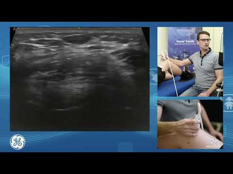 Venue Family | Anterior knee assessment and injection