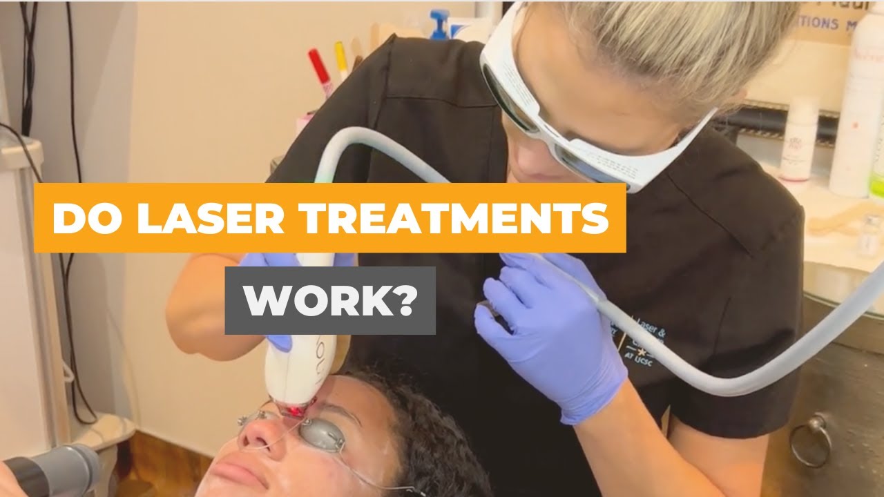 Fear Not: 4 Reasons Not To Be Afraid of Laser Treatments