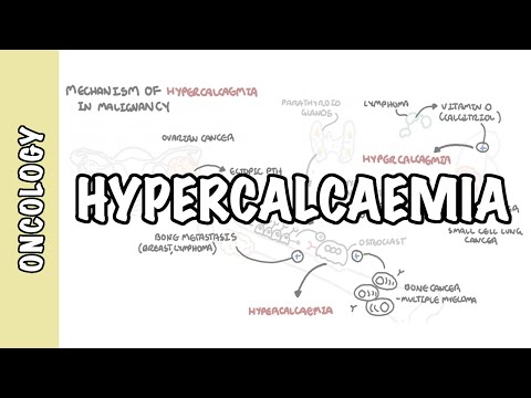 Hypercalcemia (Oncology Emergency) - Causes, Pathophysiology, Symptoms, Treatment