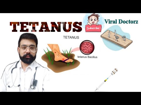 Tetanus:-(Lockjaw): Causes, types,Symptoms,Diagnosis,Treatment/Hindi/Parminder Sharma