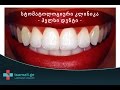 სტომატოლოგიური კლინიკა ჰელსი დენტი