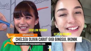 Download lagu Chelsea Olivia Cabut Gigi Gingsul Ikonik SELEBRITA... mp3