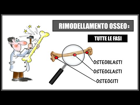 Villi sinovite articolare Vesciche sulle nocche