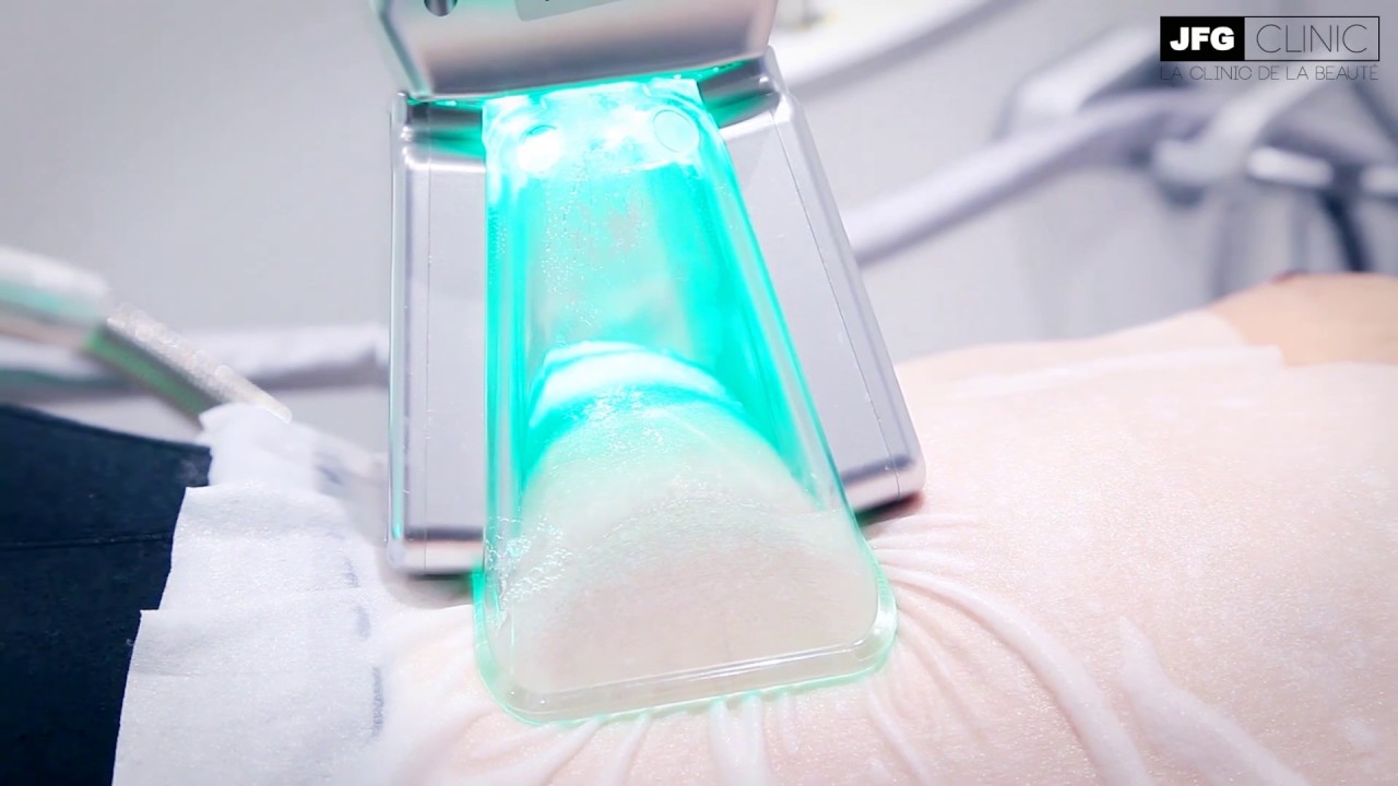 JFG Clinic, la franchise experte de l’amincissement pour elle et pour lui