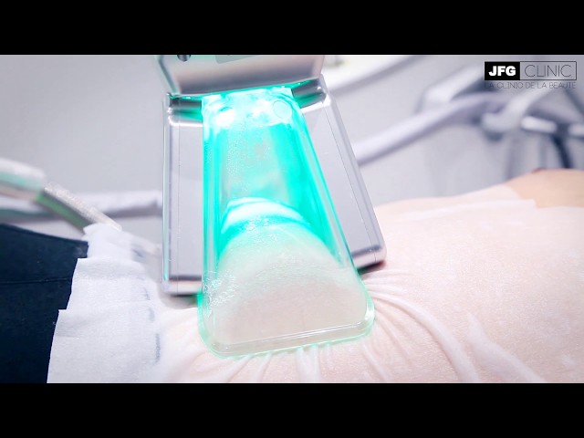 JFG Clinic, la franchise experte de l’amincissement pour elle et pour lui