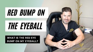 WHAT IS A RED EYE BUMP ON MY EYEBALL?