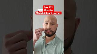 Download lagu Day 255 After Stopping the Minoxidil Beard Journey Permanent Beard Result? #beardgrowth mp3
