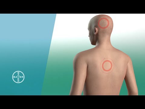 Behandlung von Erkältungen Nackenmuskulatur Was für Übungen sollte, wenn eine Wunde im unteren Rückenbereich getan werden