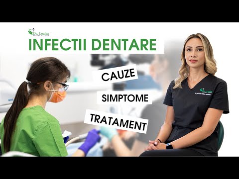 Infectii dentare: cauze, simptome si tratament – Clinicile Dentare Dr. Leahu