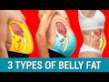 The 3 Belly Types WHICH ONE DO YOU HAVE