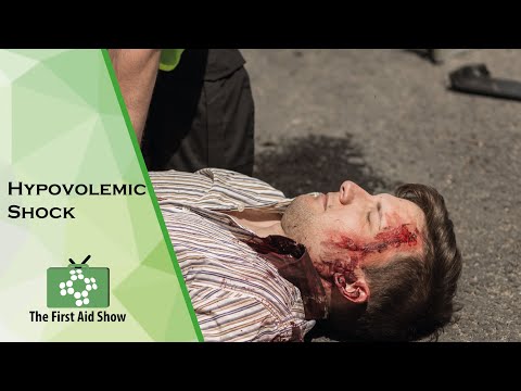 Hypovolemic Shock on The First Aid Show
