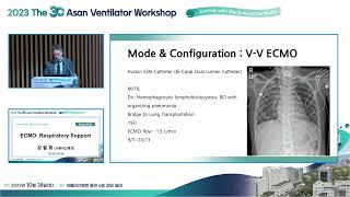 The 30th Asan Ventilator Workshop : ECMO: Respiratory Support 미리보기