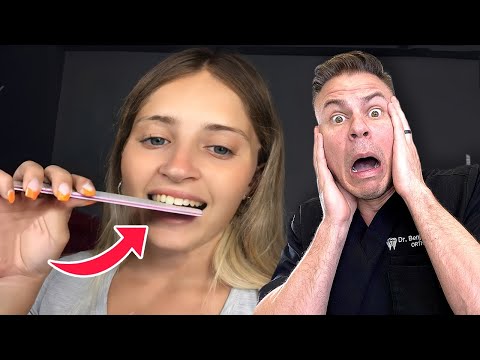 Dentist Reveals How NOT To Straighten Your Smile!
