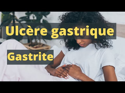 Ulcère gastrique et gastrite: causes, symptômes et traitement