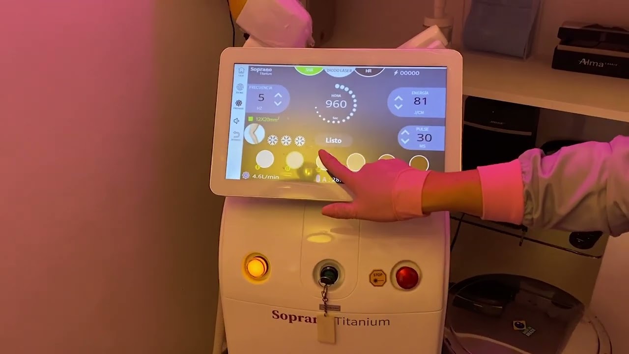 Depilación Laser con Diodo (Soprano Titanium)