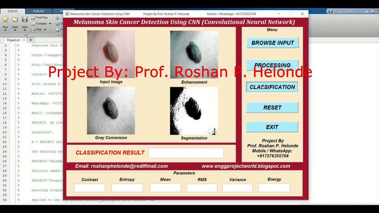 Melanoma Skin Cancer Detection Using CNN Convolutional Neural Network | Project With Source Code