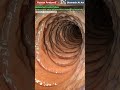 Intestines Slowed By Sitting Long Hours Animation Gut Health Human Anatomy Stomach AI Art 08