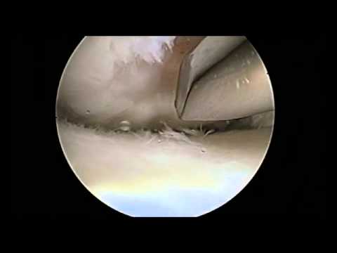 Mughetto vita fondo dolente nelle donne Dolore tra le scapole e collo