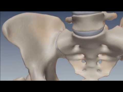 Dolore alla testa, mal di schiena, costipazione Video di fisioterapia presso linstabilità della colonna vertebrale cervicale