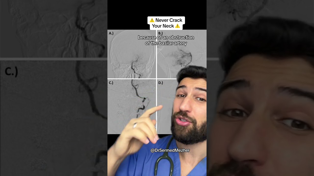 This is Why You Should Never Crack Your Neck #pain
