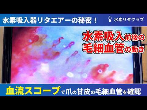リタエアーと血流スコープの参考動画のサムネイル
