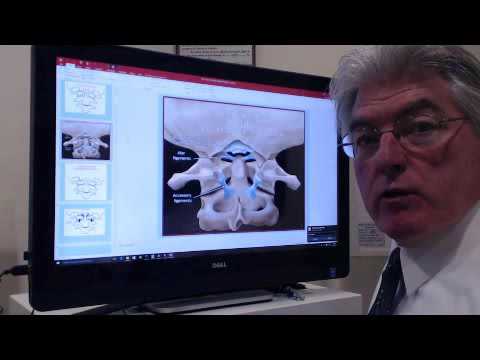 DMX Digital Motion X-Ray