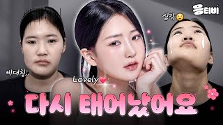 꽃다운 열아홉소녀 탄생🌷 (Part.2)｜새로운삶의시작｜임종우 원장